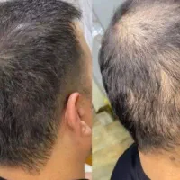 تو اقدام کنی من برات جنگل میسازم