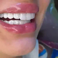 تخفیف خدمات کامپوزیت|خدمات آرایشگری و زیبایی|اهواز, زیتون کارمندی|دیوار