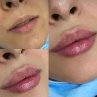 ژل هولوگرام دار اصلی سی سی 400 بوتاکس فول ۶۰۰