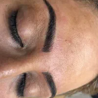 مدل فیبروز