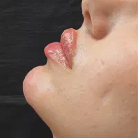 کلینیک زیبایی آفتاب|خدمات آرایشگری و زیبایی|سقز, |دیوار