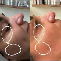 آفر ویژه آموزش وخدمات تخصصی پاکسازی، فیشال(فیشیال)|خدمات آرایشگری و زیبایی|قم, باجک یک|دیوار