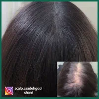 اسکالپ سر .کراتین وپروتین تراپی اپلاسیون بدن|خدمات آرایشگری و زیبایی|تنکابن, |دیوار
