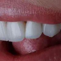دستیار دندانپزشک