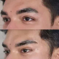 تخفیف ویژه به مدت ۲ روز مزو فیلر ژل بادی هیپ دیپ|خدمات زیبایی و سلامت|تبریز, |دیوار