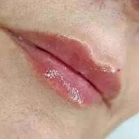 آفر ویژه تزریقات ژل و بوتاکس در کلینیک فقط ۶۸۰|خدمات آرایشگری و زیبایی|نجف‌آباد, حومه نجف آباد|دیوار
