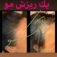 موهای بلند پرپشت داشته باشید|آرایشی، بهداشتی، درمانی|رشت, آزادگان|دیوار