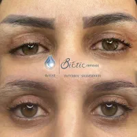 تعداد محدود،برای پاک کردن تتوفقط تماس بگیرید|خدمات آرایشگری و زیبایی|شهرکرد, |دیوار