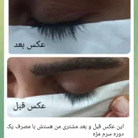 راه طبیعی رشد ابرو و مژه