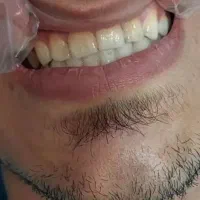 دندانپزشکی در خرم آباد با تخفیف ویژه|خدمات آرایشگری و زیبایی|دورود, |دیوار