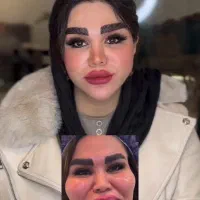 جشنواره جوانسازیMax Lift پزشک پوست مو ژل بینی ابرو|خدمات زیبایی و سلامت|مشهد, هفت تیر (حافظ)|دیوار