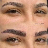 میکرو تخصصی ابرو