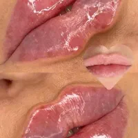 ژل و بوتاکس فقط ۳۹۰|خدمات آرایشگری و زیبایی|قم, زنبیل آباد|دیوار