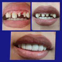 دندانپزشکی،ایمپلنت،ارتودنسی لمینت وکامپوزیت اقساطی|خدمات آرایشگری و زیبایی|نجف‌آباد, شریعتی غربی|دیوار