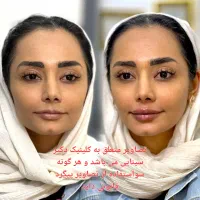 تزریق ژل و بوتاکس و لیزر در مطمئن ترین کلینیک مشهد|خدمات آرایشگری و زیبایی|مشهد, احمدآباد|دیوار