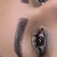 فیبروز میکروبلیدینگ.