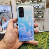 Redmi note 11 تمیز ترینه بازار به شرط