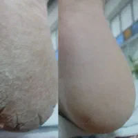اسپاپدیکور تخصصی پا**جوانسازی و روشن کنندگی دست