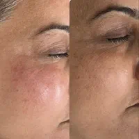 اموزشوانجامپاکسازیوفیشیالدرمانیتخصصی