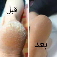 پدیکور و کف سازی پا