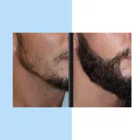 ابهت چهرتو بساز