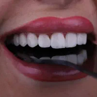دندانپزشکی ایمپلنت کامپوزیت|خدمات آرایشگری و زیبایی|تهران, صادقیه|دیوار