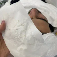 فیشال تخصصی بانوان و آقایان*کلینیک لیان