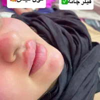 جشنواره‌دو برابرخرید۳لاین+۱،رایگان+هدیه معرفی دوست