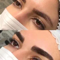 کاشت ابرو و فیلر بیکینی