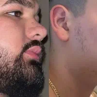 کاشت ممنوع