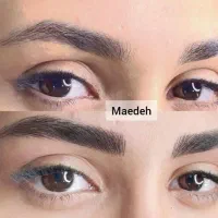 میکروبلیدینگ وفیبروزابرو950