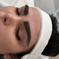 کاشت مو و ابرو میکرو کاشت (رایگان)|خدمات زیبایی و سلامت|تهران, مرزداران|دیوار