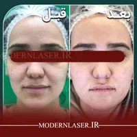 درمان کامل انواع لک پوستی توسط پزشک|خدمات آرایشگری و زیبایی|اصفهان, سعادت‌آباد|دیوار