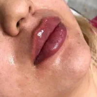 تزریق ژل و بوتاکس و کاشت نخ و مزوژل های جوان ساز|خدمات آرایشگری و زیبایی|شیراز, ابیوردی|دیوار