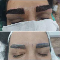 کلینیک مجوزدار کاشت ابرو در قم|خدمات آرایشگری و زیبایی|قم, ارم|دیوار
