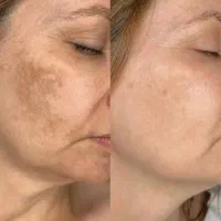 فیشال فقط350