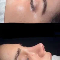 آف جراحی بینی فقط 45 اهواز