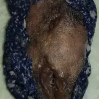 انگشتر قدیمی