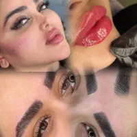 تخفیف ویژه فیلر و بوتاکس ۵۹۹