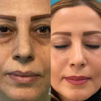 کرم بیوممتیک ضد چروک جوانسازی
