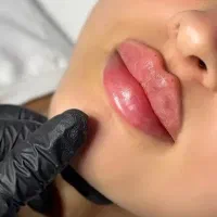 کلینیک زیبایی VIP ژل و بوتاکس تخصصی|خدمات زیبایی و سلامت|اصفهان, تیران|دیوار