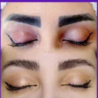 ریموو تتو های قدیمی