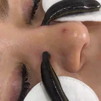 رگگیری.اصلاحی.زالودرمانی.حجامت.اصلاحی|خدمات آرایشگری و زیبایی|کاشان, دشت چال|دیوار