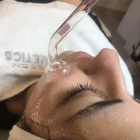 پاکسازی و فیشال پوست|خدمات زیبایی و سلامت|مشهد, هنرستان|دیوار