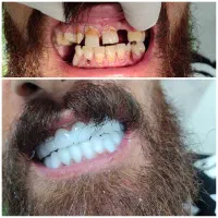 دندان پزشکی و دندانسازی طرف قرارداد با بیمه ها