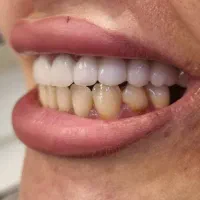 تخفیف روز دختر شروع شد تا روز میلاد امام هشتم