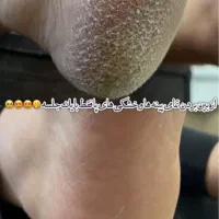 پدیکور و کف سابی و فیشیال