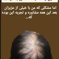 درمان قطعی ریزش مو