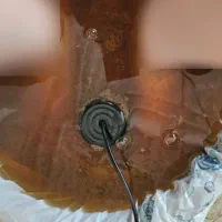 دستگاه یون تراپی