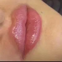 انجام تمامی خدمات فیلر و بوتاکس|خدمات آرایشگری و زیبایی|سبزوار, توحیدشهر|دیوار